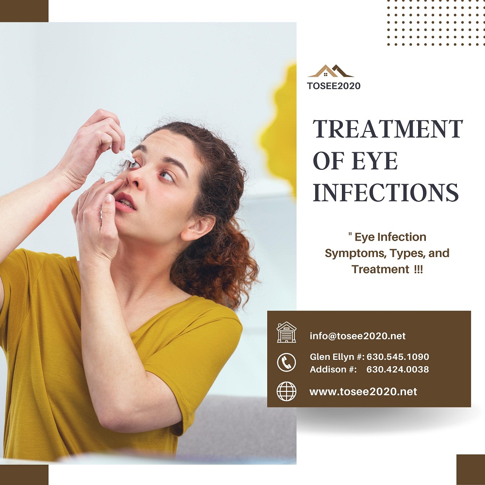 Treatment Of Eye Infections Lisle