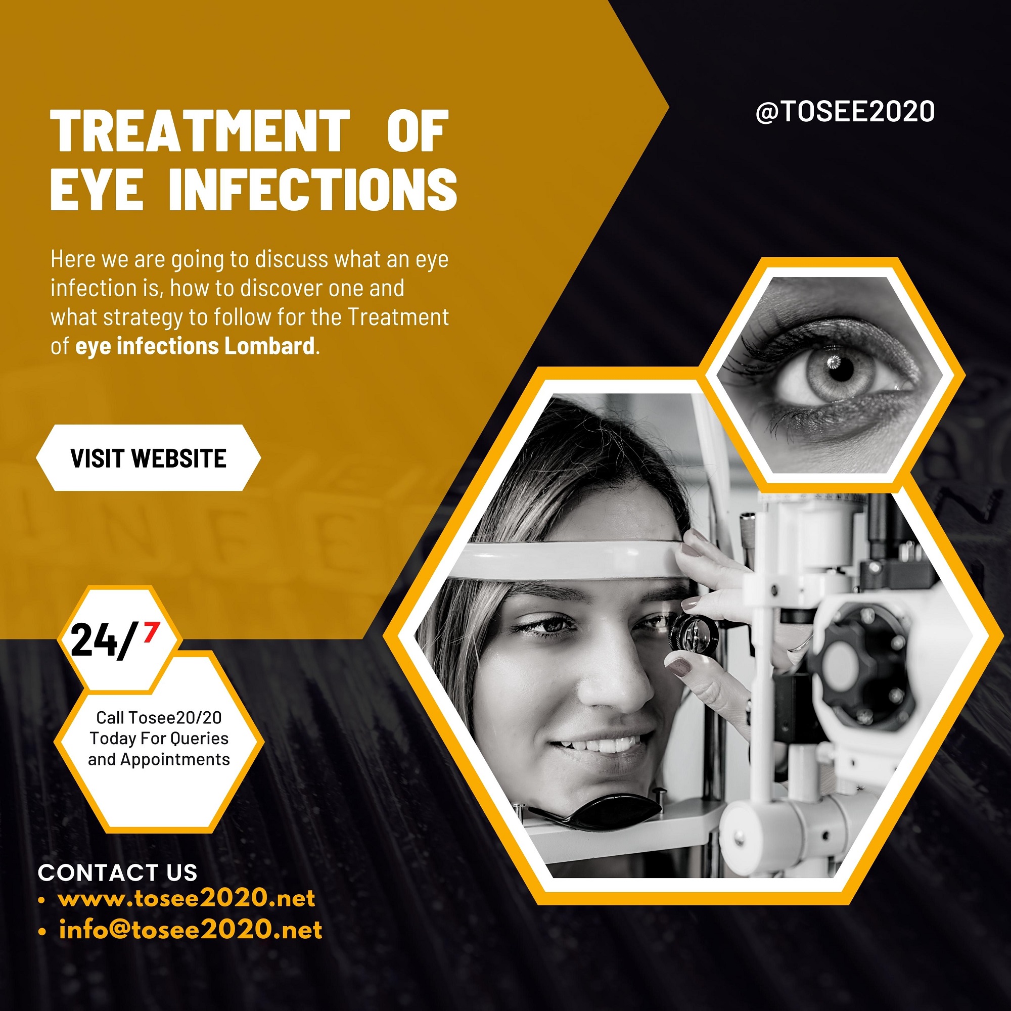 Treatment Of Eye Infections Lombard