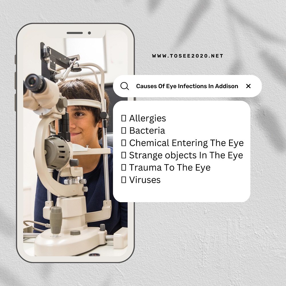 Addison Eye Doctor’s Informative Guide On Eye Infections In 2023